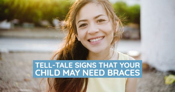 Tell-Tale Signs That Your Child May Need Braces