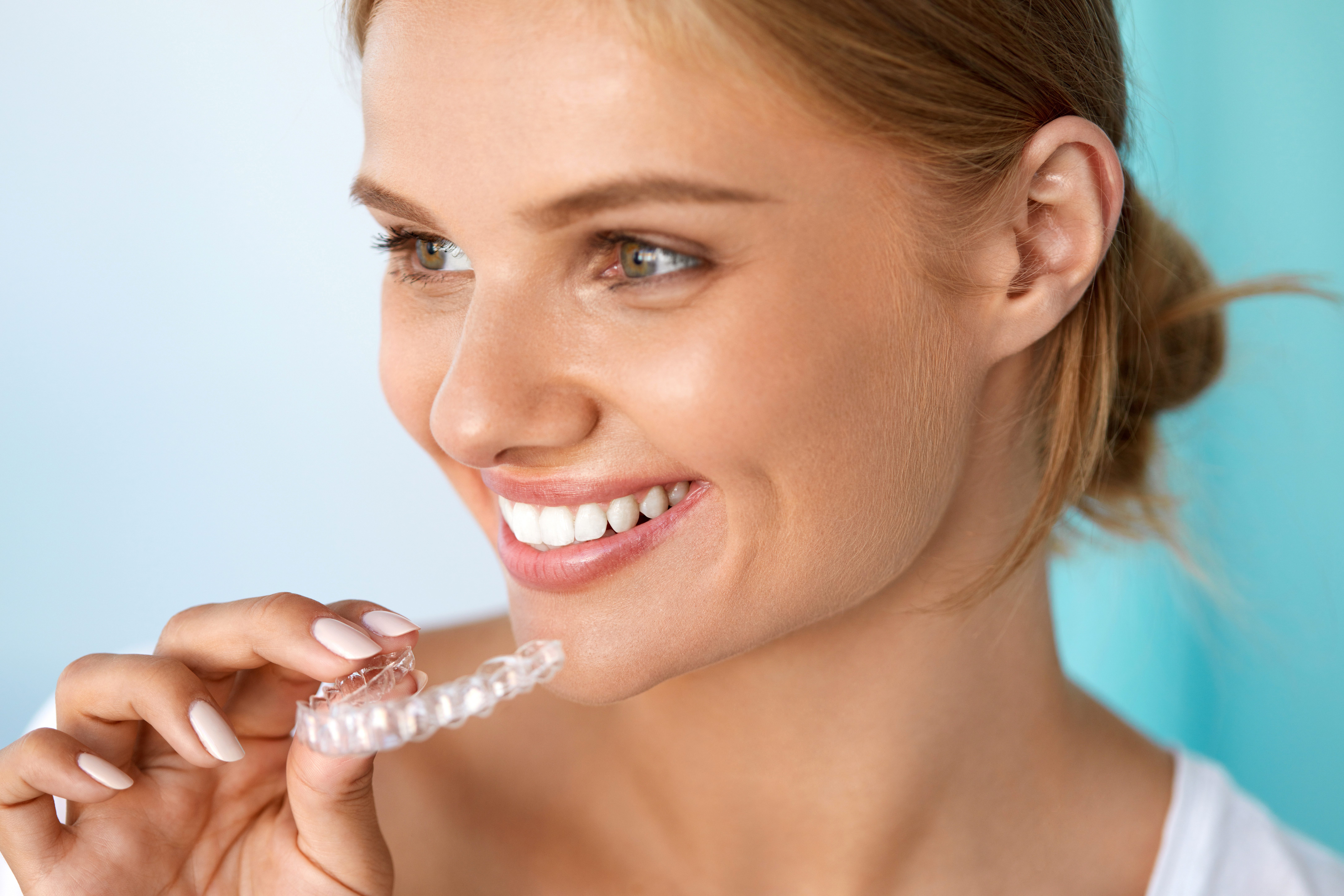Smile Touch-Ups with Clear Aligners in Central Florida
